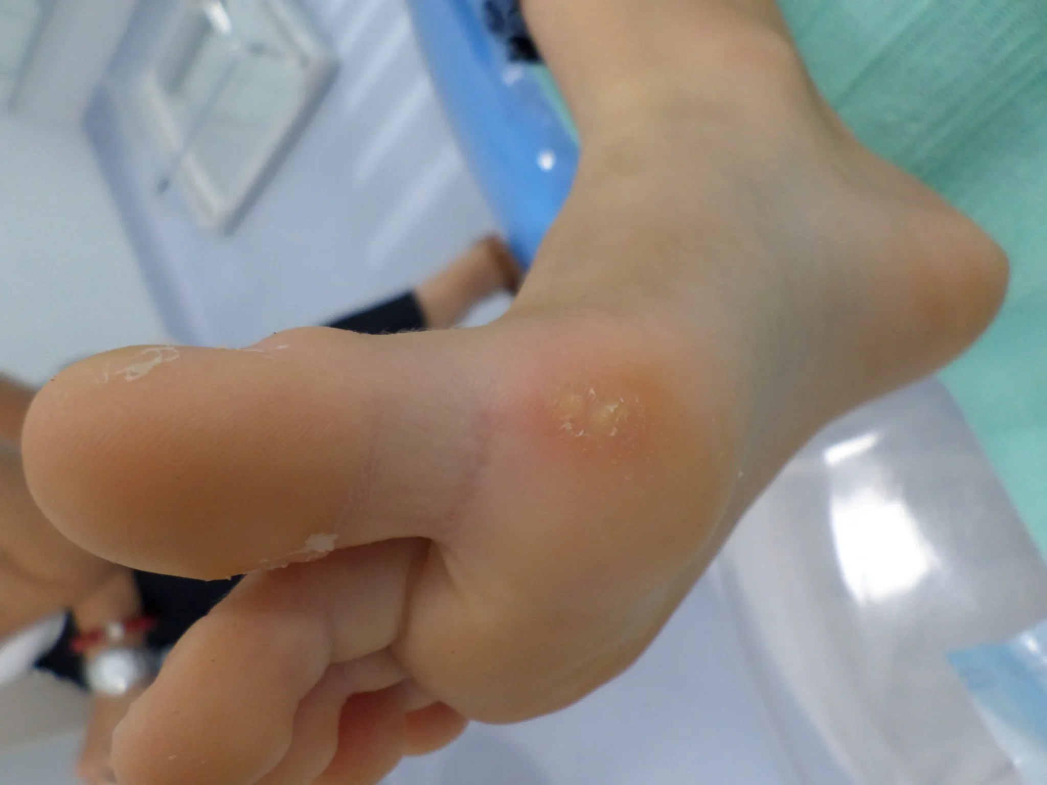 dermatología-podológica